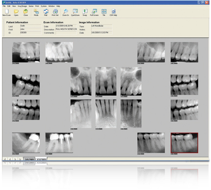 panoramic teeth for cdr dicom